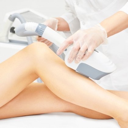 vascular laser treatment to reduce veins and discoloration in the skin